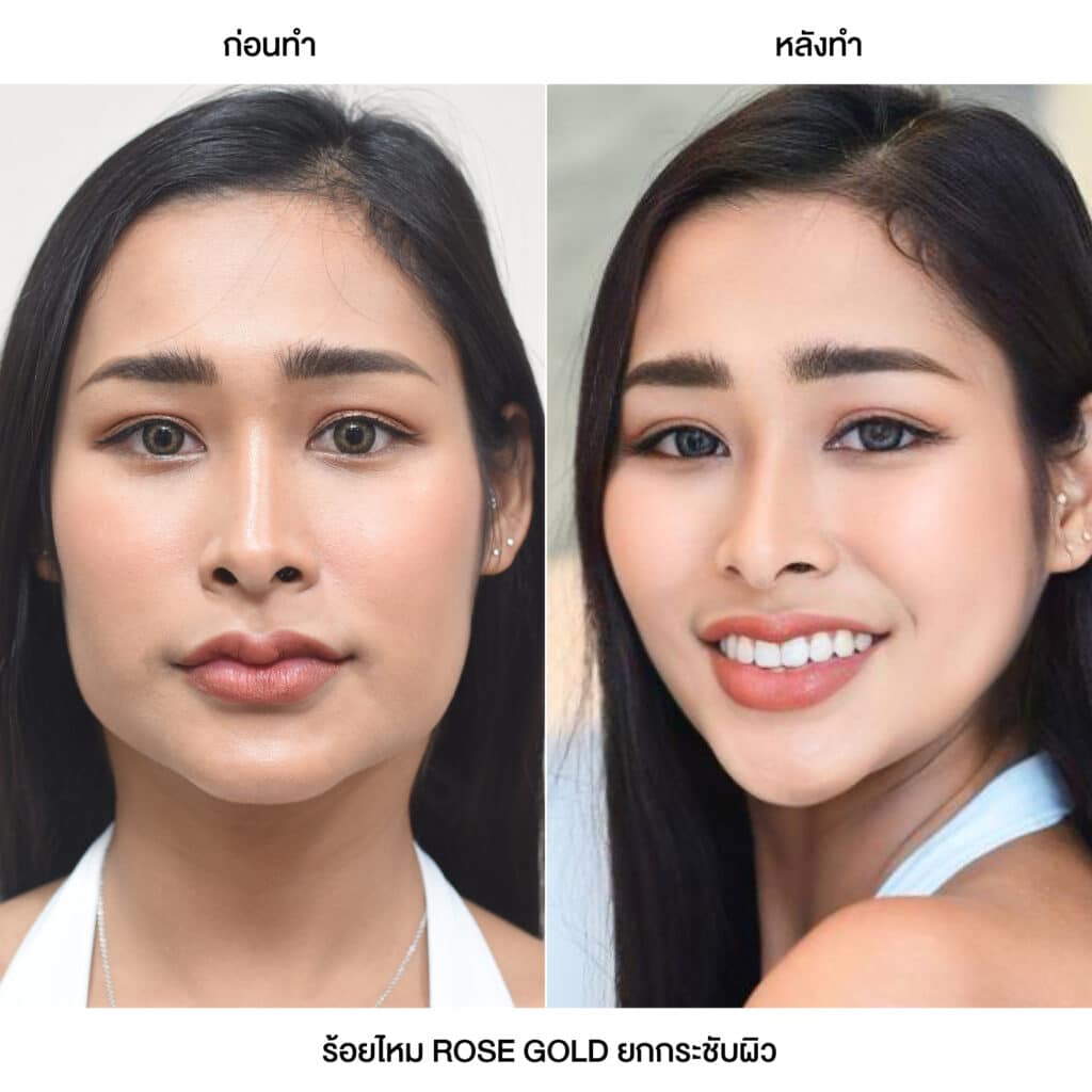 รวมรีวิวลูกค้า ร้อยไหม ROSE GOLD (2)